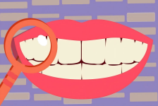 背”锅“的洗牙